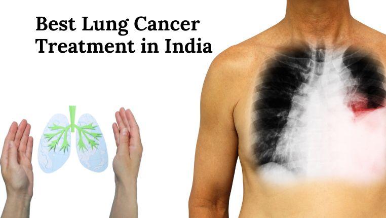 best lung cancer treatment in india